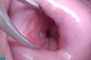 Japanese Wed Open Cervix Wide to watch inside Uterus